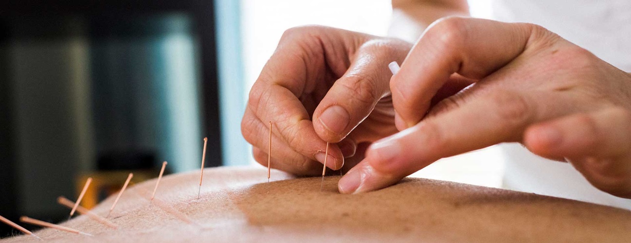 The Healing Touch of Acupuncture Understanding Its Benefits and Applications